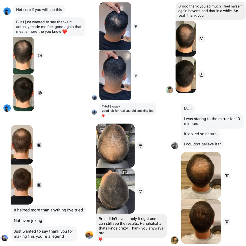 Rooty 2.0 Hair Loss Powder